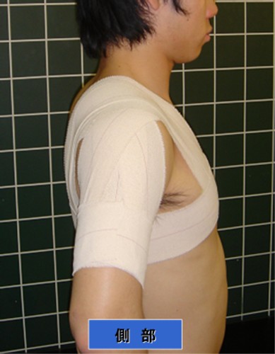 pic1